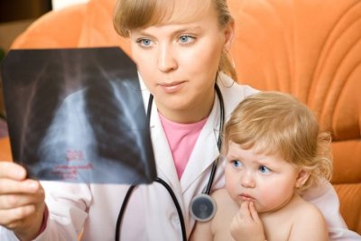 Пневмония у детей. Причины и лечение заболевания
